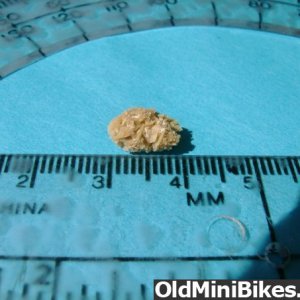 kidney_stone